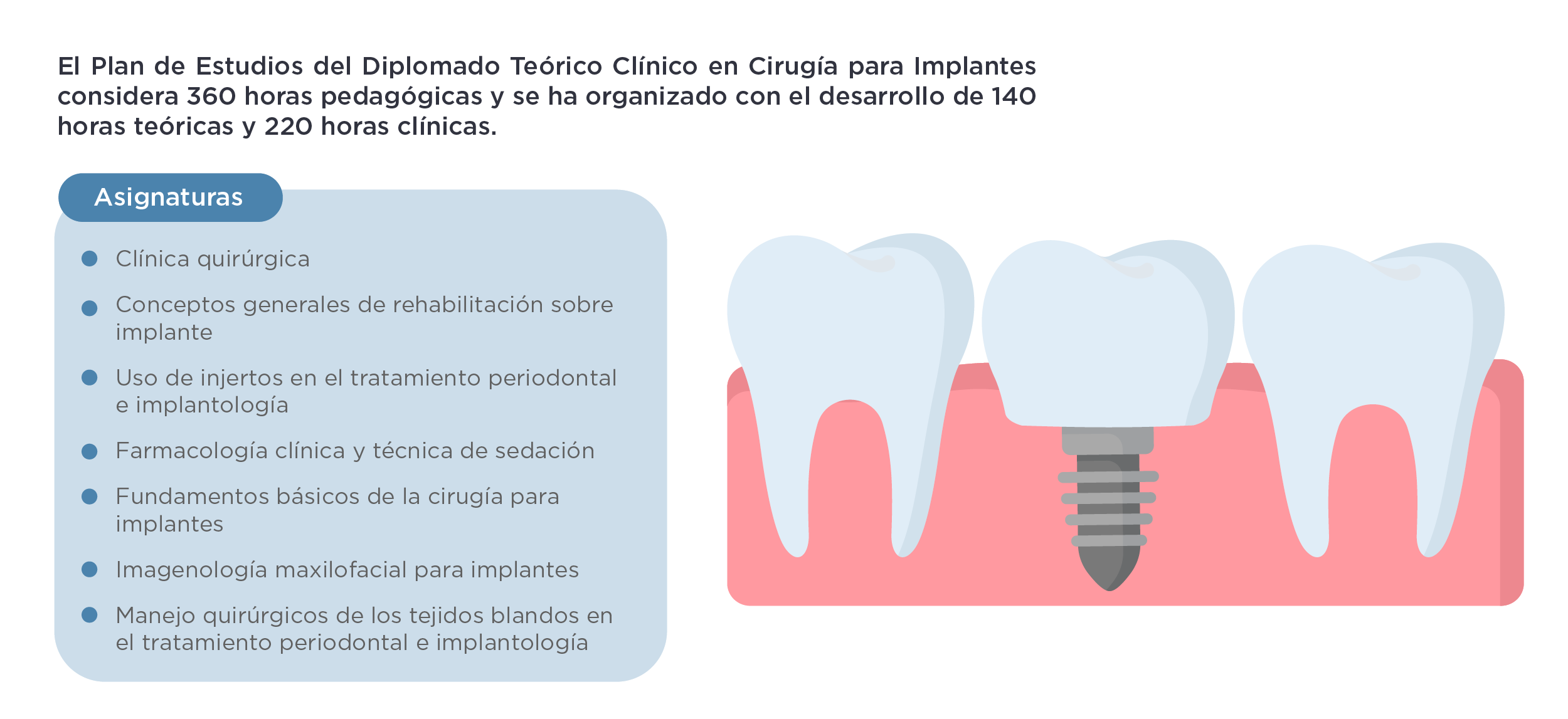 Diplomado Teórico Clínico en Cirugía para Implantes 