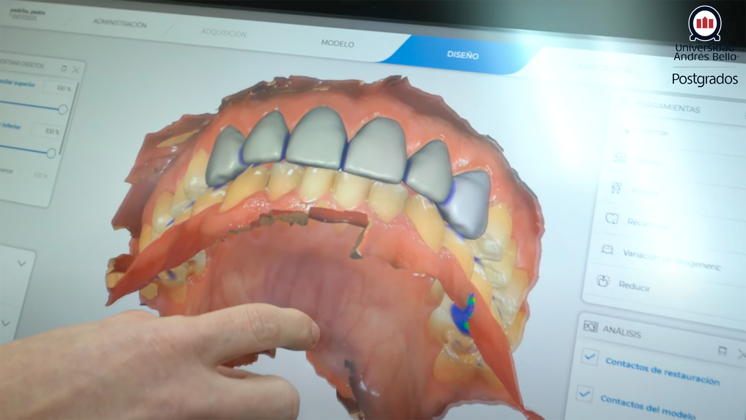 Especialización en Rehabilitación Oral