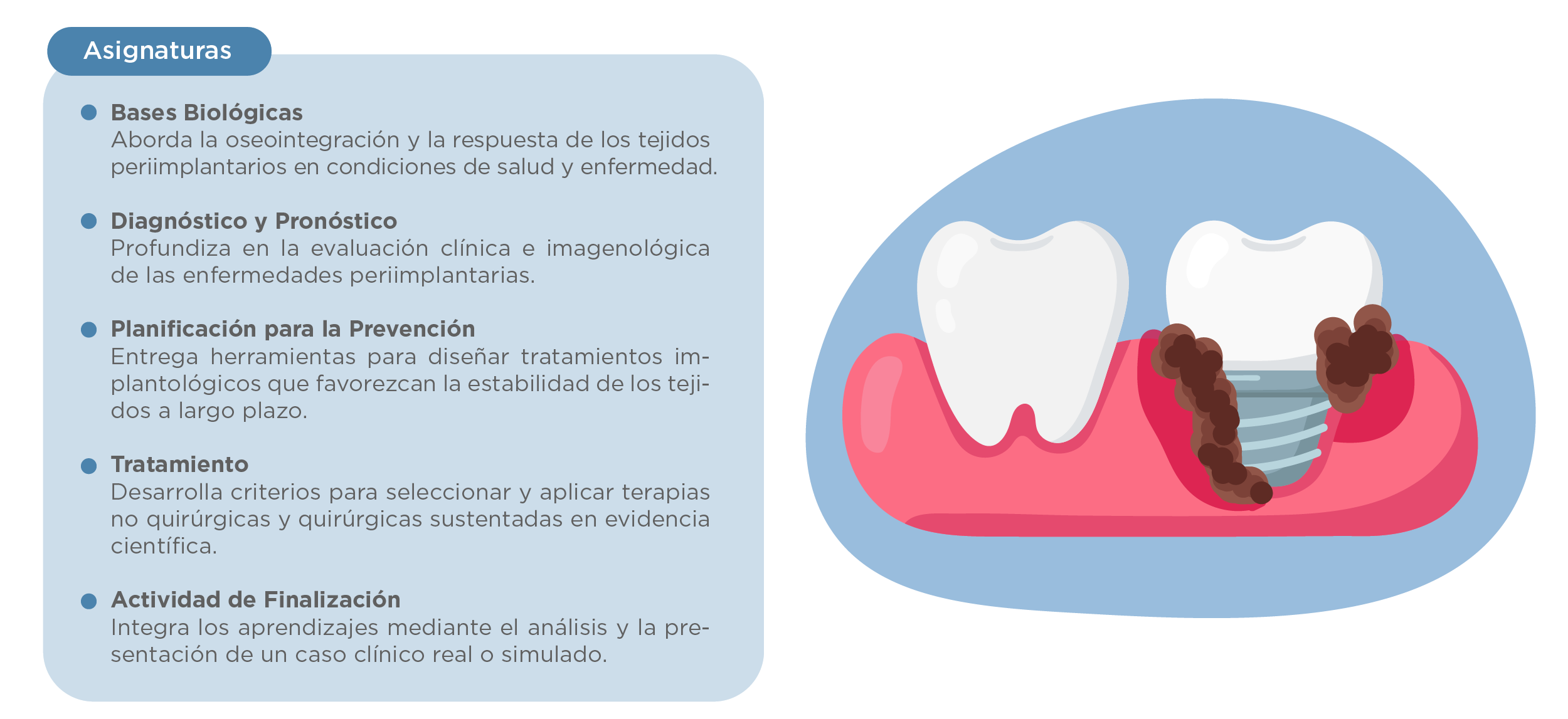 Plan de estudios Diplomado en Bases Biológicas y Tratamientos de las Enfermedades Periimplantarias